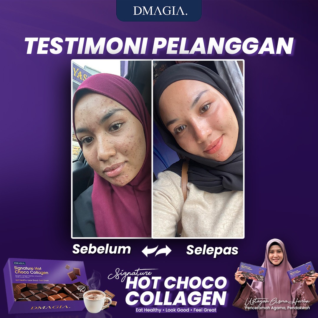 Testimoni pelanggan DMAGIA - Yanti