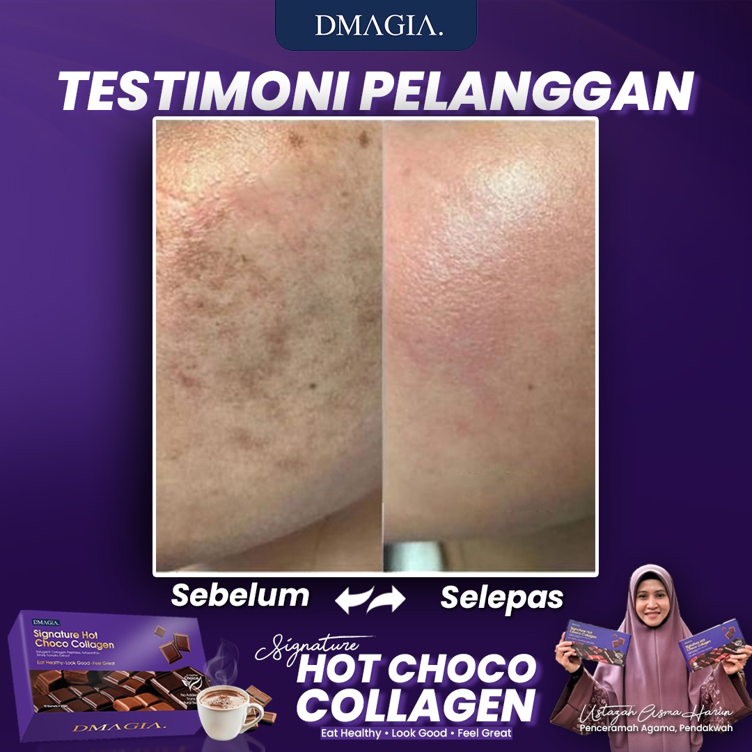 Before after pelanggan DMAGIA 1