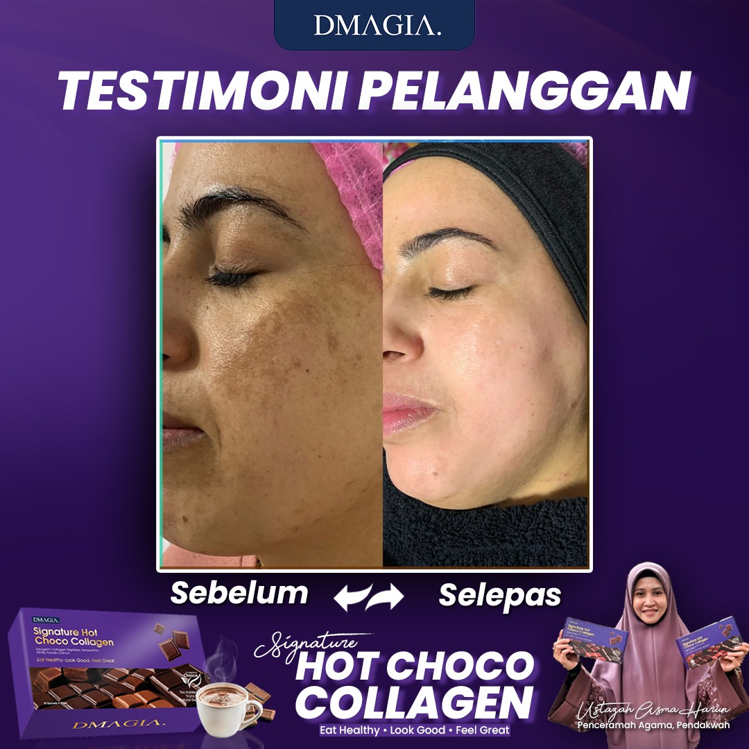 Before after pelanggan DMAGIA 2
