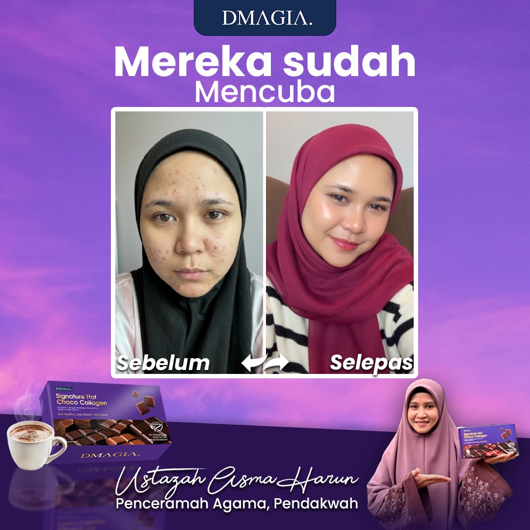 Testimoni pelanggan DMAGIA - Putri